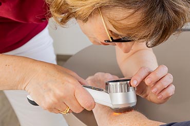 Hautkrebsvorsorge Dermatologie im Sheridanpark, Augsburg